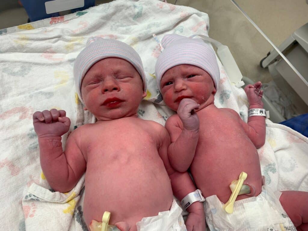 Newborn twins conceived via embryo donation.